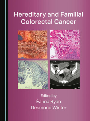 cover image of Hereditary and Familial Colorectal Cancer
